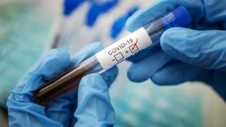 Уменьшилось число заболевших коронавирусом за сутки в Казахстане
