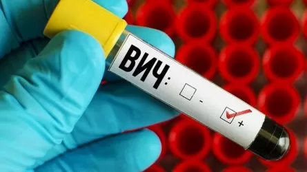 В Казахстане только в сентябре выявили более 325 новых ВИЧ-инфицированных  