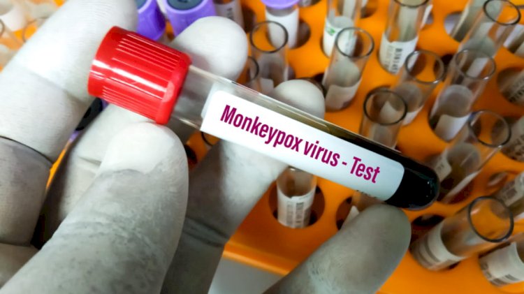 Может ли вспышка обезьяньей оспы быть следствием атаки биотеррористов?
