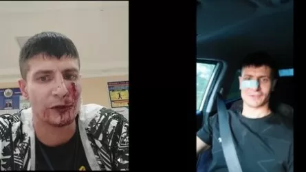 В Усть-Каменогорске совершено нападение на журналиста Антона Князева