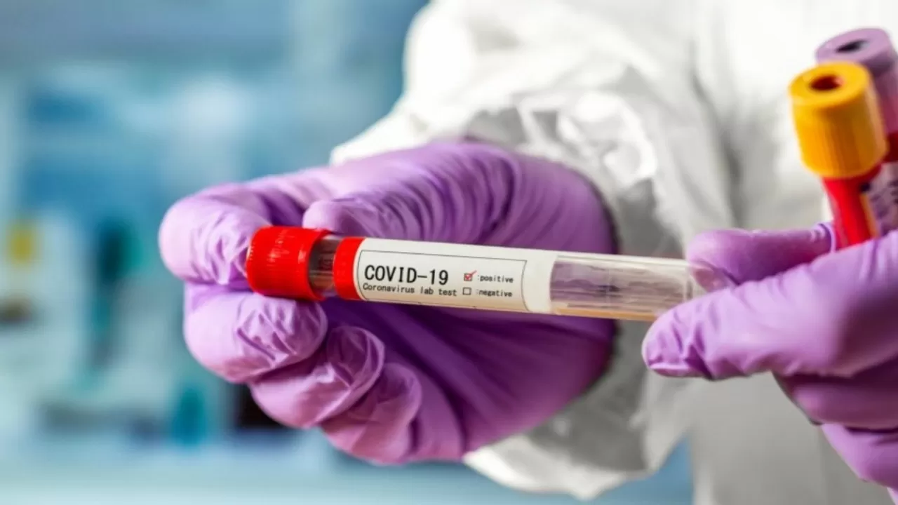 Стало известно число заразившихся коронавирусом в Казахстане
