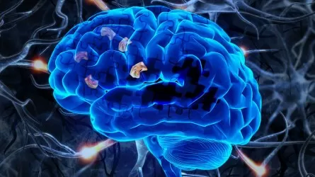 Ученые выявили новый признак болезни Альцгеймера