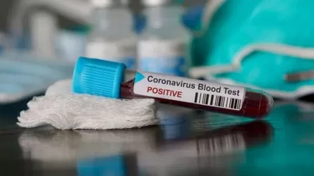 70 адамнан коронавирус пен пневмония анықталды