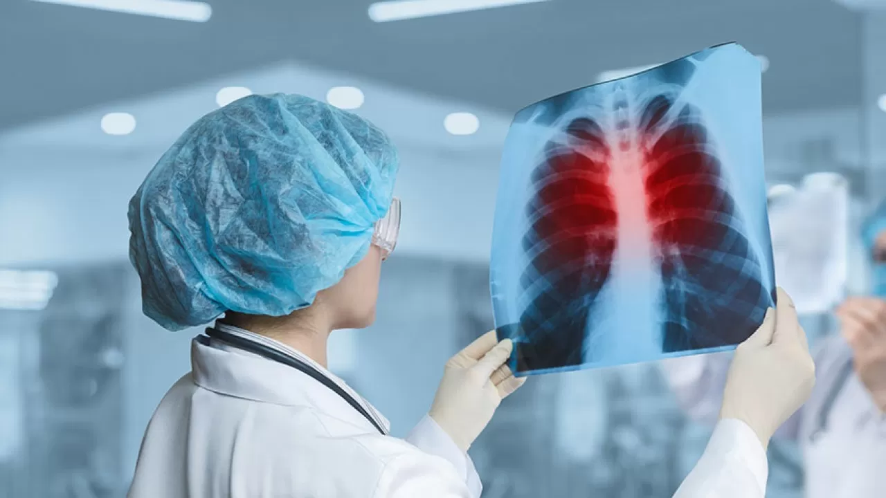 Енді туберкулезді жедел анықтайтын заманауи әдіс қолданылады