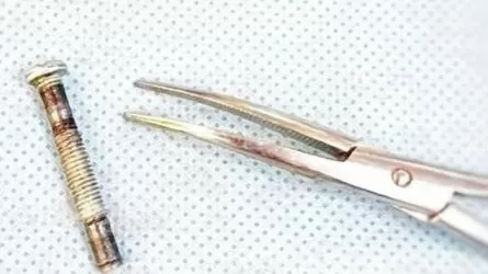 Медики извлекли болт из горла годовалого ребенка в Туркестанской области 