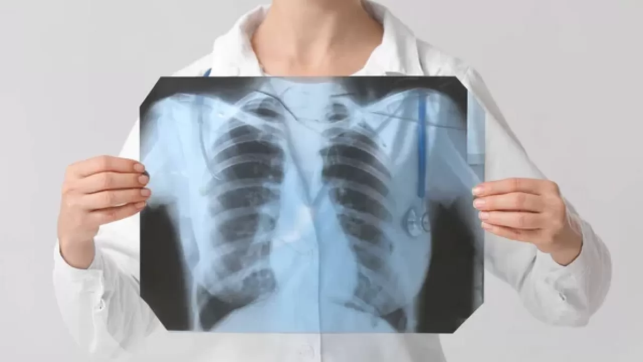 Один пульмонолог на область: медицина задыхается без специалистов