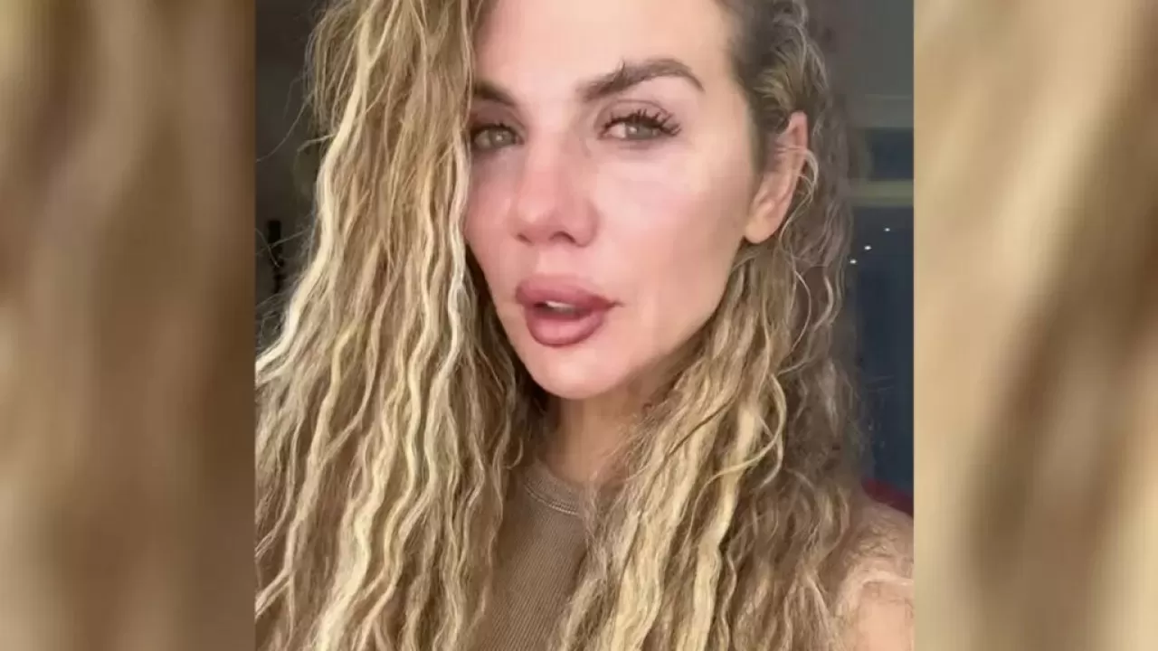 Певица Анна Седокова сообщила, что к ней вернулась cтрашная болезнь 