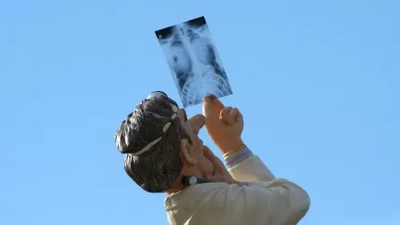 Как будет проходить в РК скрининг рака легкого: подробности 