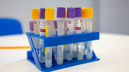 Казахстан ежегодно тратит миллиарды на лечение и профилактику ВИЧ-инфекции