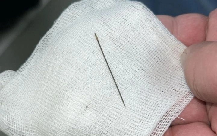 Түркістанда 8 айлық сәбидің ішінен ине шықты