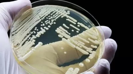 Өте жұқпалы вирус әлемге қауіп-қатер тудырып тұр