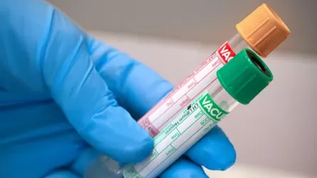 Елімізде ірі зертханалар желісіне қатысты тергеу басталды