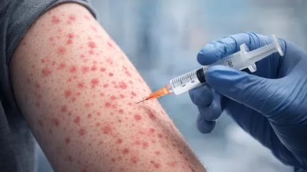 Вакцинация от кори упала ниже 95% в Казахстане 