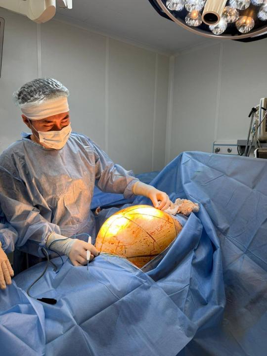 Алматыда дәрігерлер 25 келілік алып ісікті алып тастады 