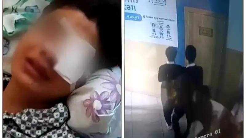 Жамбылда төбелестен соң мектеп оқушысының көзі көрмей қалды