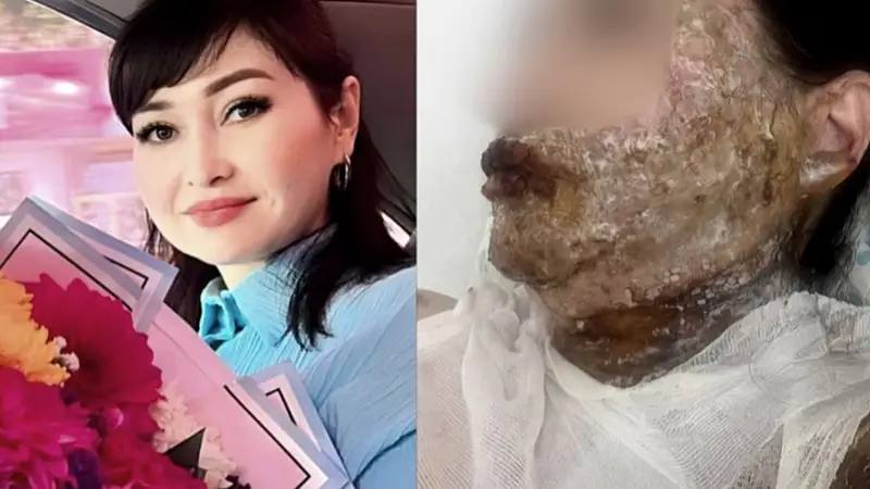 &laquo;Мен сені адам танымастай етемін&raquo;: Шымкентте бұрынғы әйеліне қышқыл төккен күдікті ұсталды