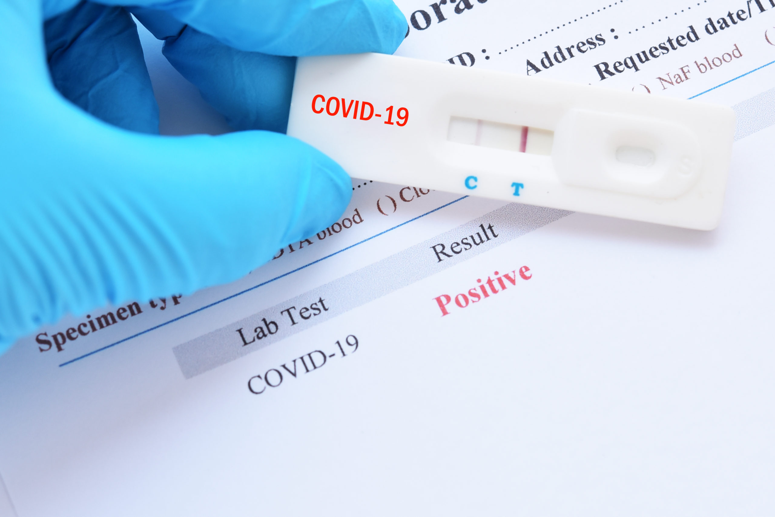 В Казахстане могут ввести обязательное тестирование на COVID-19 членов избиркомов и наблюдателей на предстоящих выборах   