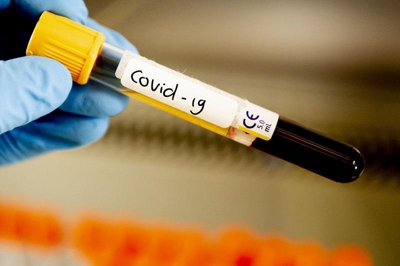 В Казахстане снижаются темпы распространения COVID-19 