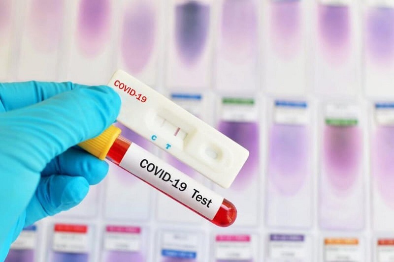 Порядка 4500 тестов на коронавирус обрабатывают в столице   