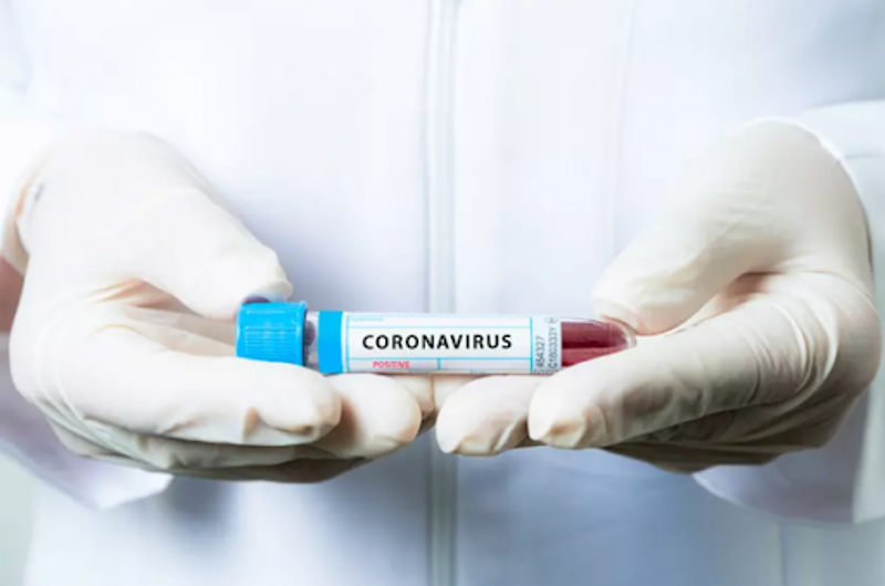 Стало известно, сколько человек заразилось коронавирусом в Казахстане 
