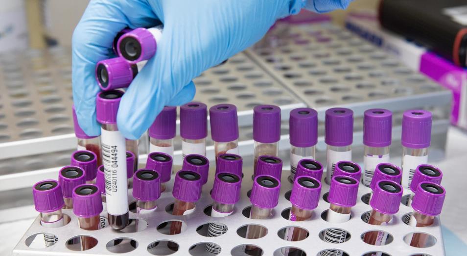 Әлемде COVID-19 инфекциясын жұқтырғандар 122,7 миллионнан асты 
