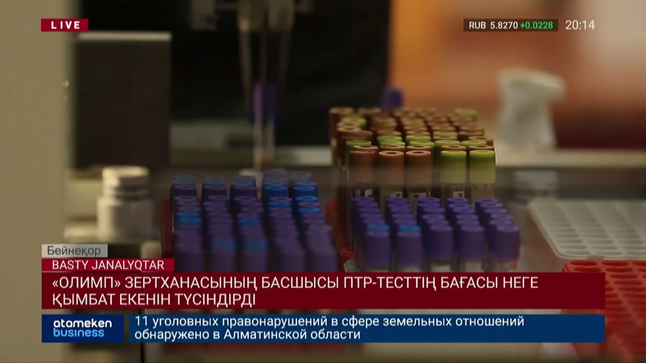 «Олимп» зертханасының басшысы ПТР-тесттің бағасы неге қымбат екенін түсіндірді  