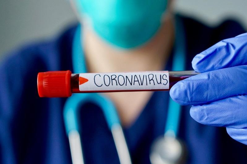  Қарағандыда тағы 2 адамнан коронавирус анықталды    